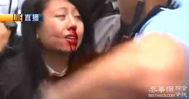 【元朗反水客】少女遭打爆鼻浴血遭警员按地制服带走