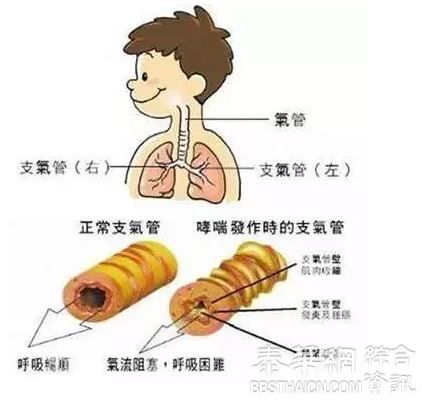 性格决定你的疾病