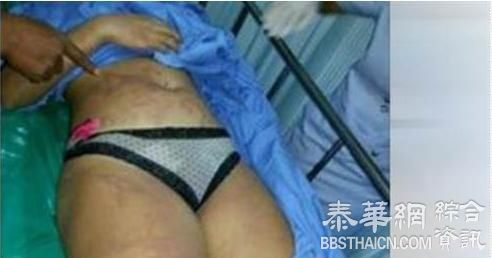 游泰注意！海滩度假变调 女遭毒水母螫死