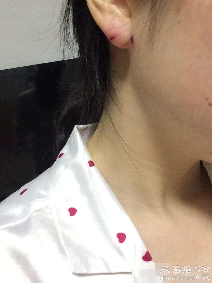 台湾籍男子在上海一医院装扮警察电击女子