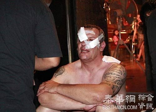 外籍男游客芭堤雅吃霸王餐 起衝突被揍  一脸是伤