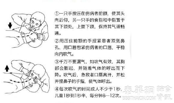 突发意外    每人都应学会的急救技能