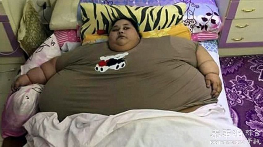 全球最肥女重逾半吨 25年来无法下床
