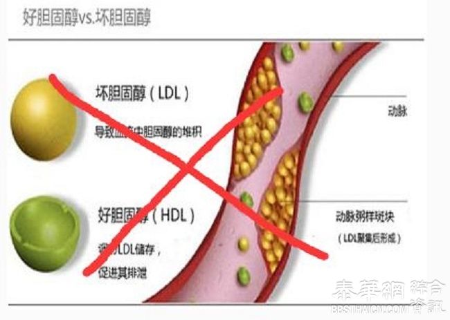 修改了40年来重大错误：胆固醇有益无害，不再分好坏