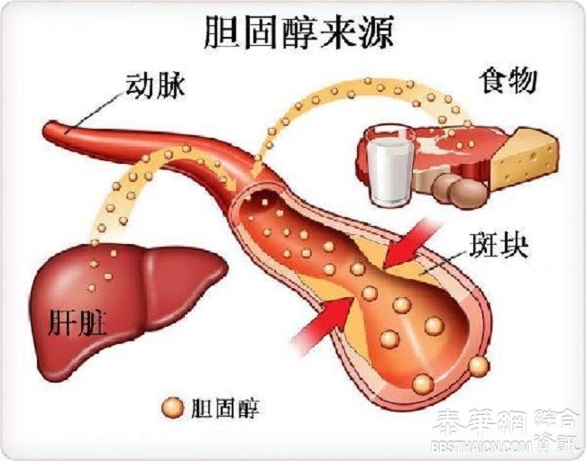 修改了40年来重大错误：胆固醇有益无害，不再分好坏